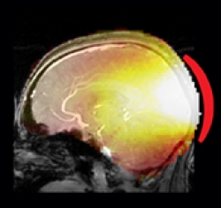 在局部功能脑试验中增强MR信号